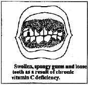 Biology, Class 9, Health and Disease, Types of Diseases, Symptoms